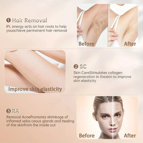 Sarlisi IPL Laser Hair Removal Device – 999,900 Flashes 9 Modes for Women & Men!